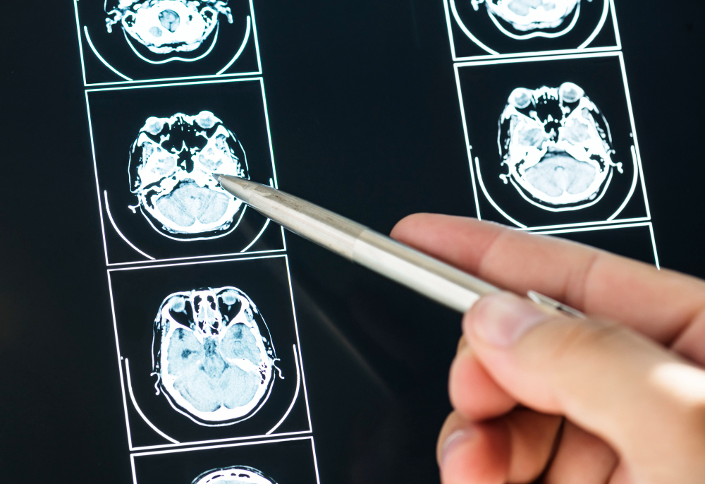 Atención de trauma craneoencefálico y de columna - Dr. Jose Alejandro Romero Acosta